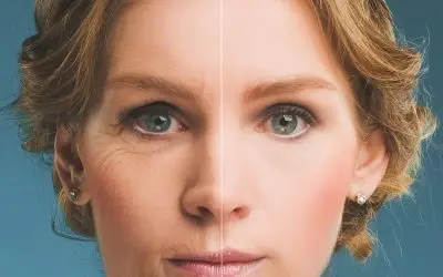 Botox before and after pictures